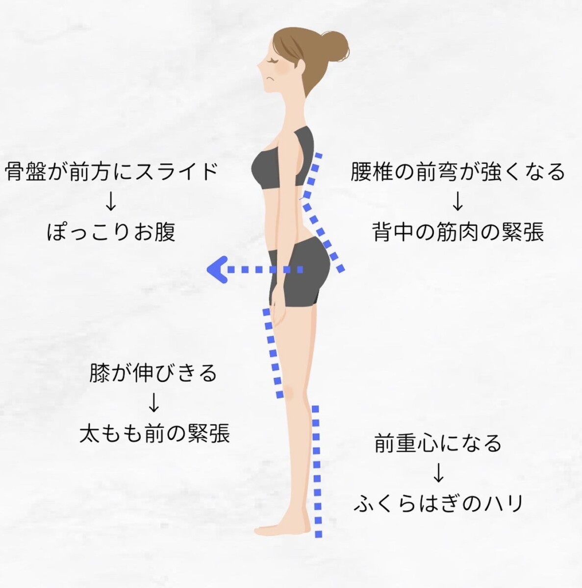 身体に必要なセルフケア　反り腰 キャッチ画像